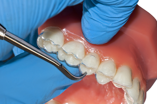 Comprehensive Care at Manchester’s Premier Private Dental Practices